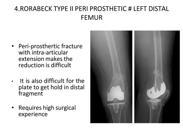 High-End Surgery