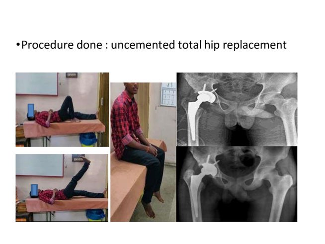 High-End Surgery