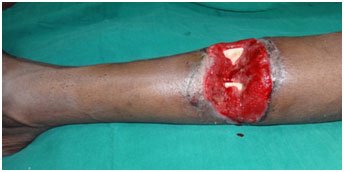 Microsurgery