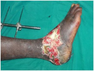Microsurgery